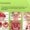 Острая респираторная вирусная инфекция