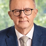 Anthony Albanese