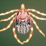 Fiebre hemorrágica de Crimea-Congo