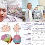 electroencefalogramă (eeg)