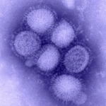 Virusul gripei A subtip H1N1