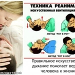 Искусственное дыхание